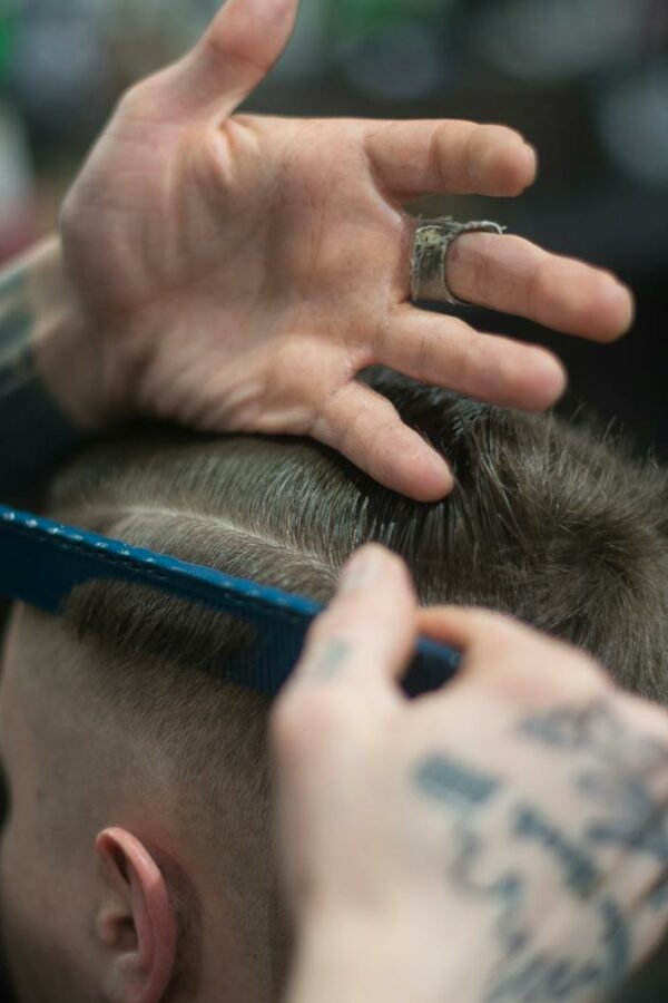 Medical Tourism Surge Sees Athletes Trading Millions for Thousands in Hair Treatment